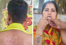 प्रधान समेत 13 पर मारपीट, लूट व जानलेवा हमले का मुकदमा दर्ज